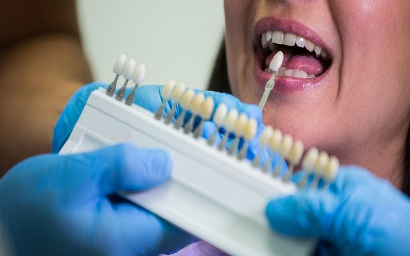 From Flaws to Perfection: The Power of Cosmetic Dentistry in  listed under Services - Healthcare / Fitness