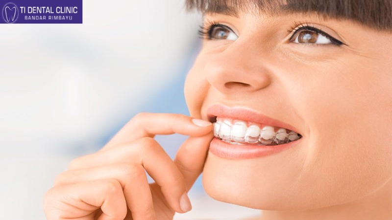 Invisible braces dentist in  listed under Services - Healthcare / Fitness
