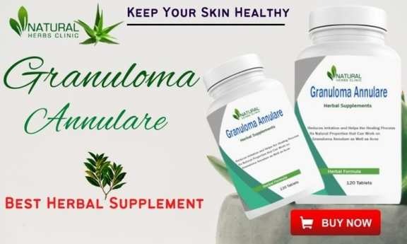 Herbal Supplement for Granuloma Annular in  listed under Services - Healthcare / Fitness