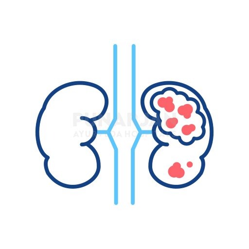 Best Kidney Cancer Treatment Hospitals in Hyderabad in  listed under Services - Healthcare / Fitness