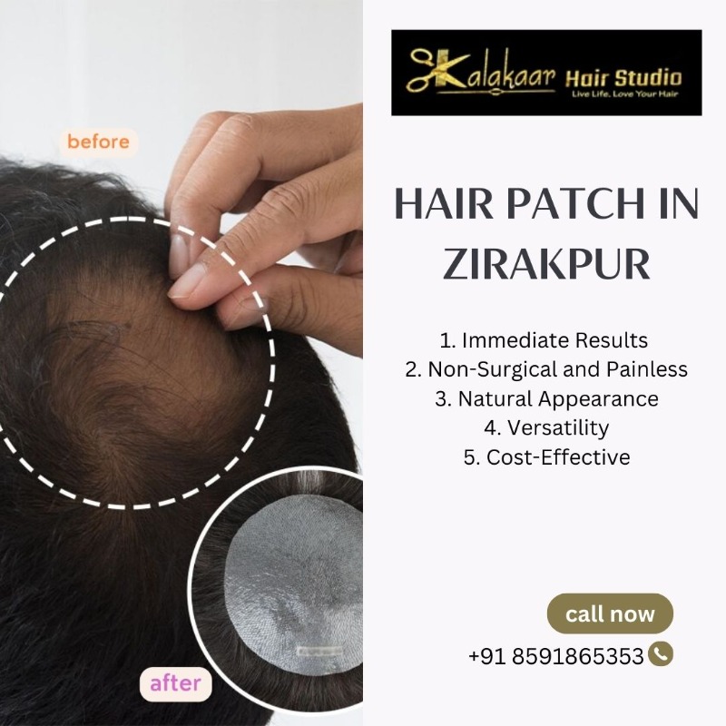 Best Hair Patch In Zirakpur- Kalakaar Hair Studio in  listed under Services - Parlor / Salons