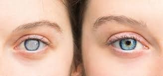 Best Glaucoma Surgeon in Madurai in  listed under Services - Doctors