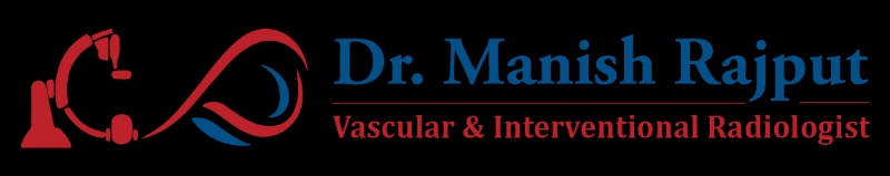 Varicose Veins Doctor near me